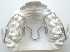 solucion de ortodoncia pul 3