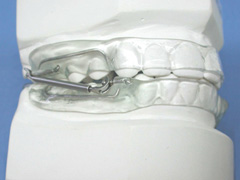 Dispositivo ortodoncia removible pul 17